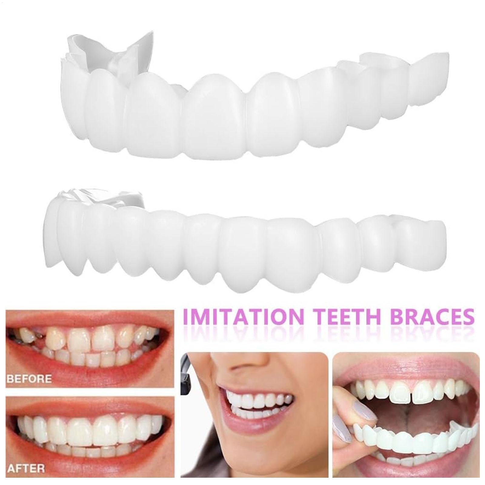 Teeth Whitening In Office - Dental Upper Lower Fake Teeth Cover