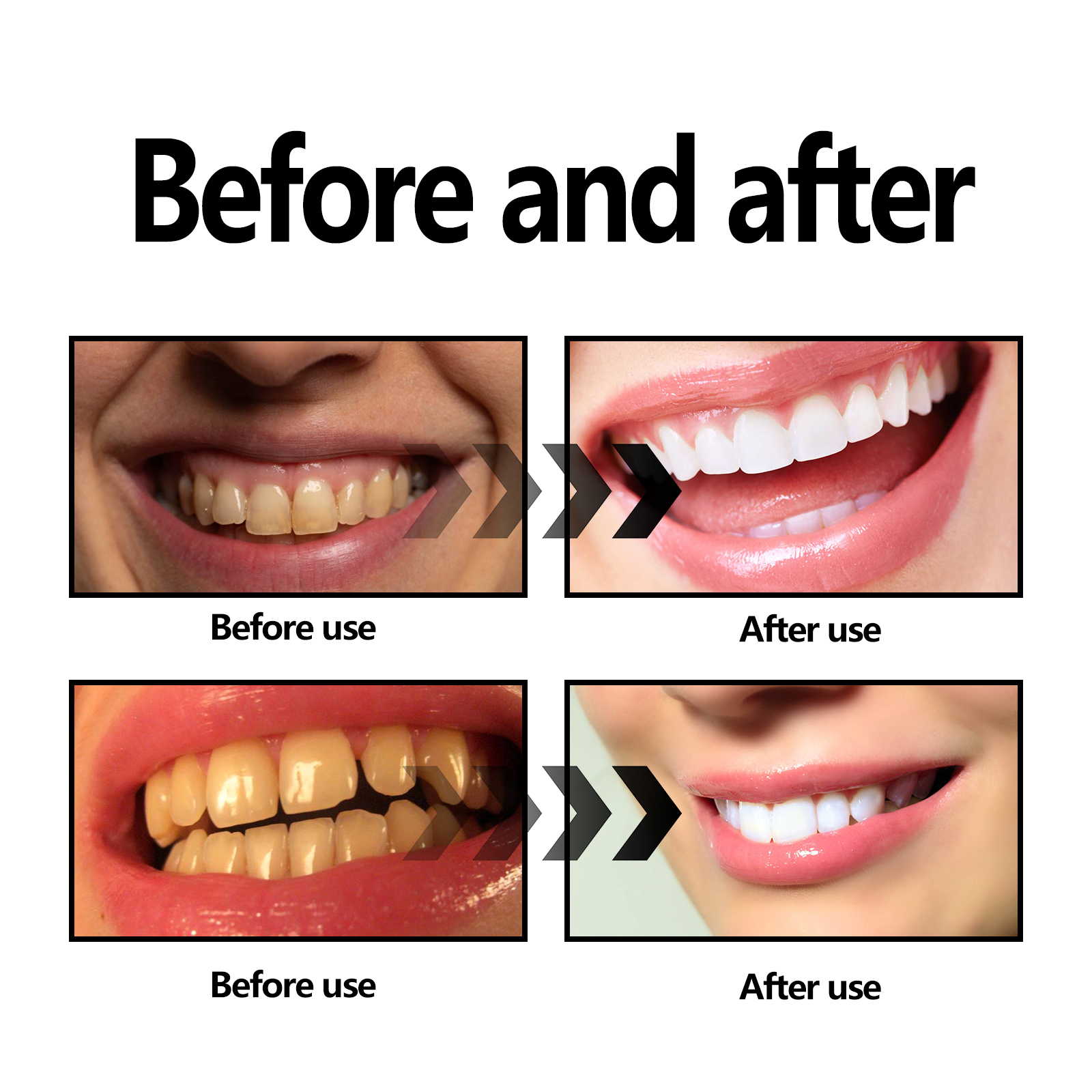 Activated Coconut Charcoal Too - Teeth Whitening Charcoal avaliação e preço