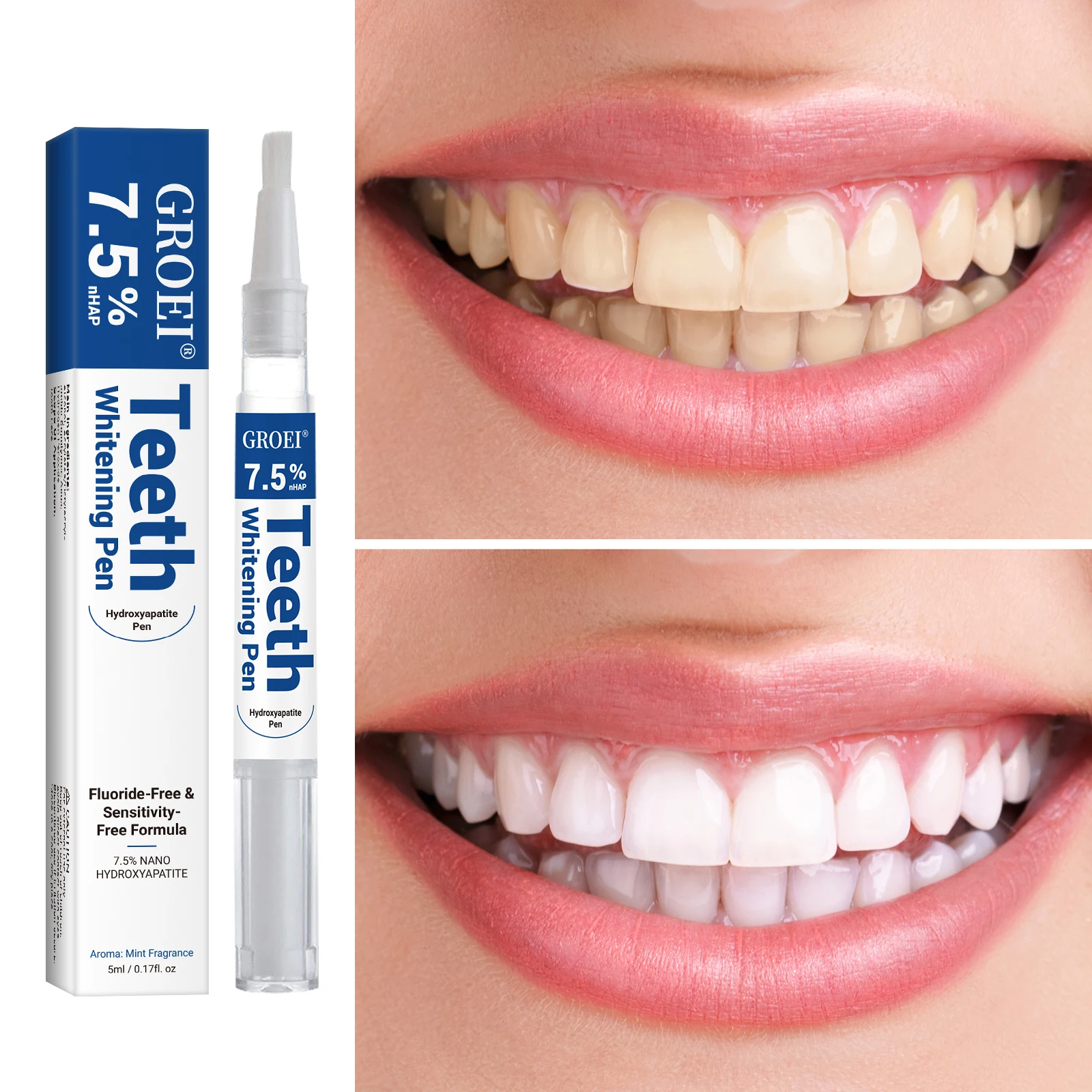 Hydroxyapatite Tooth Whitening - Teeth Whitening Singapore avaliação e preço