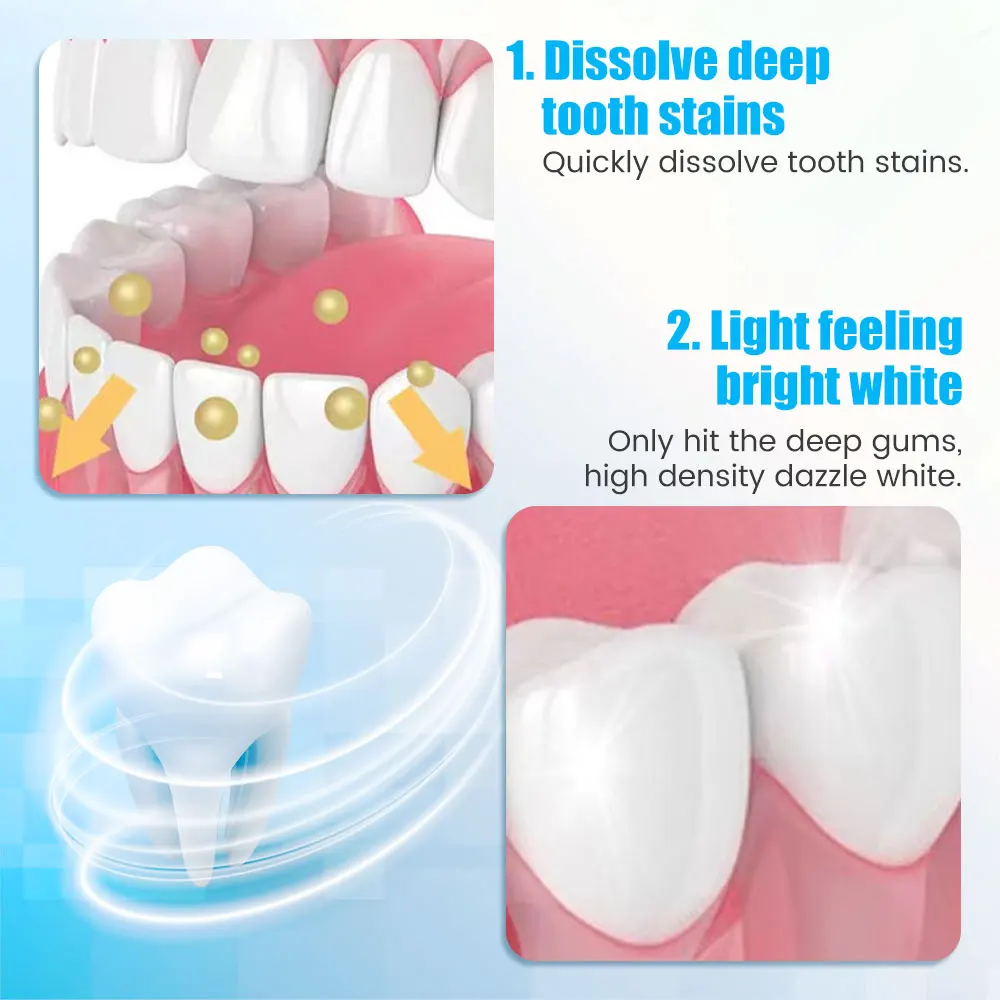 9D Teeth Whitening Stickers Mi - Teeth Whitening Effective avaliação e preço