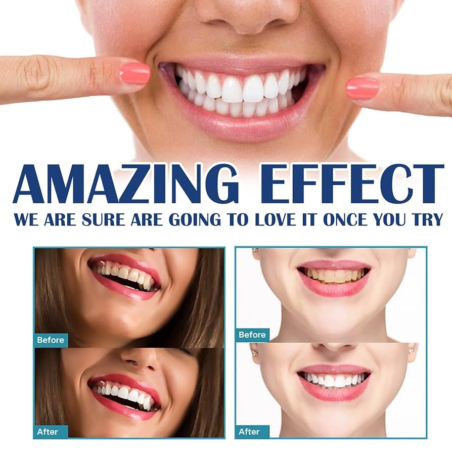 Teeth Whitening Stickers Mint  - Teeth Whitening Gel Refills avaliação e preço