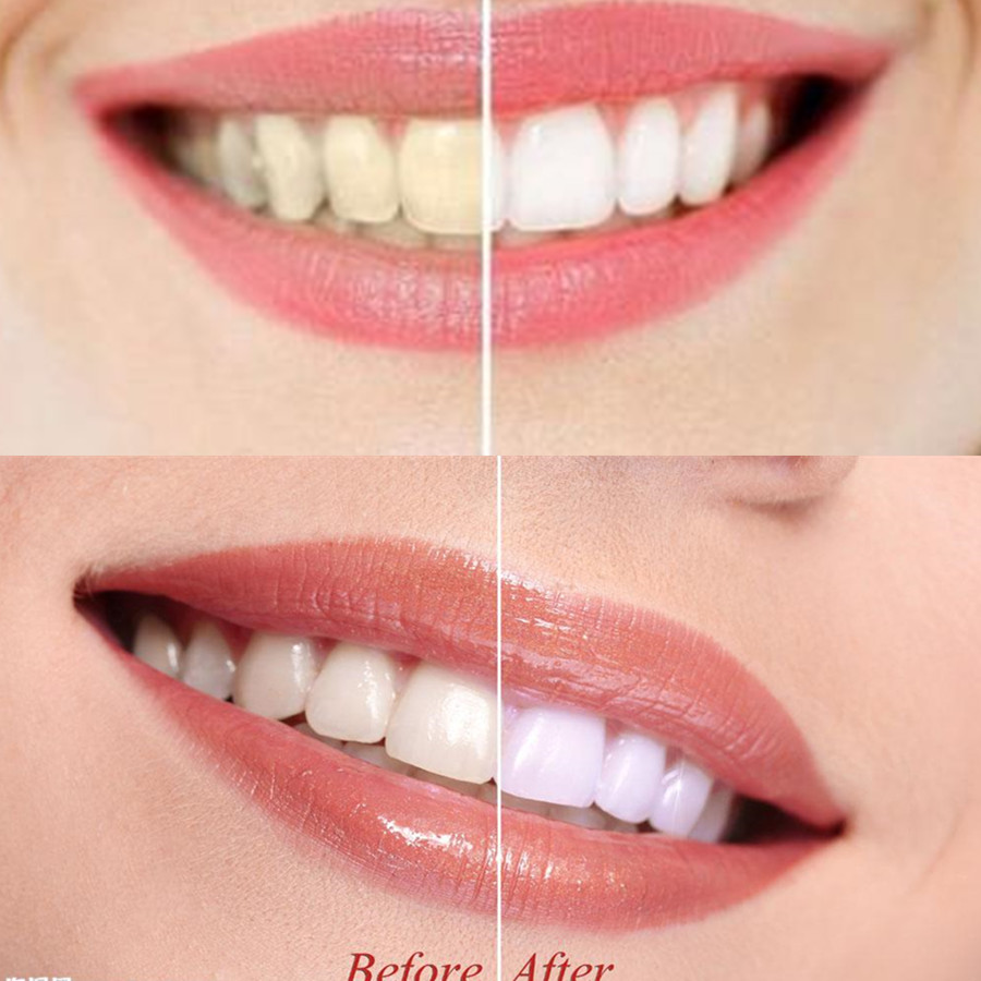 Bamboo Charcoal Teeth Tooth De - Teeth Whitening Singapore avaliação e preço
