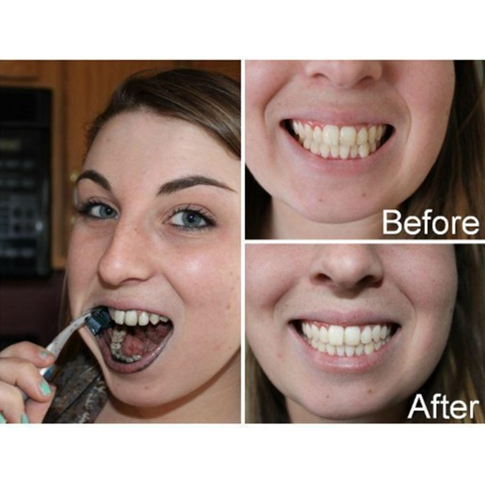 Bamboo Charcoal Teeth Tooth De - Teeth Whitening Singapore avaliação e preço