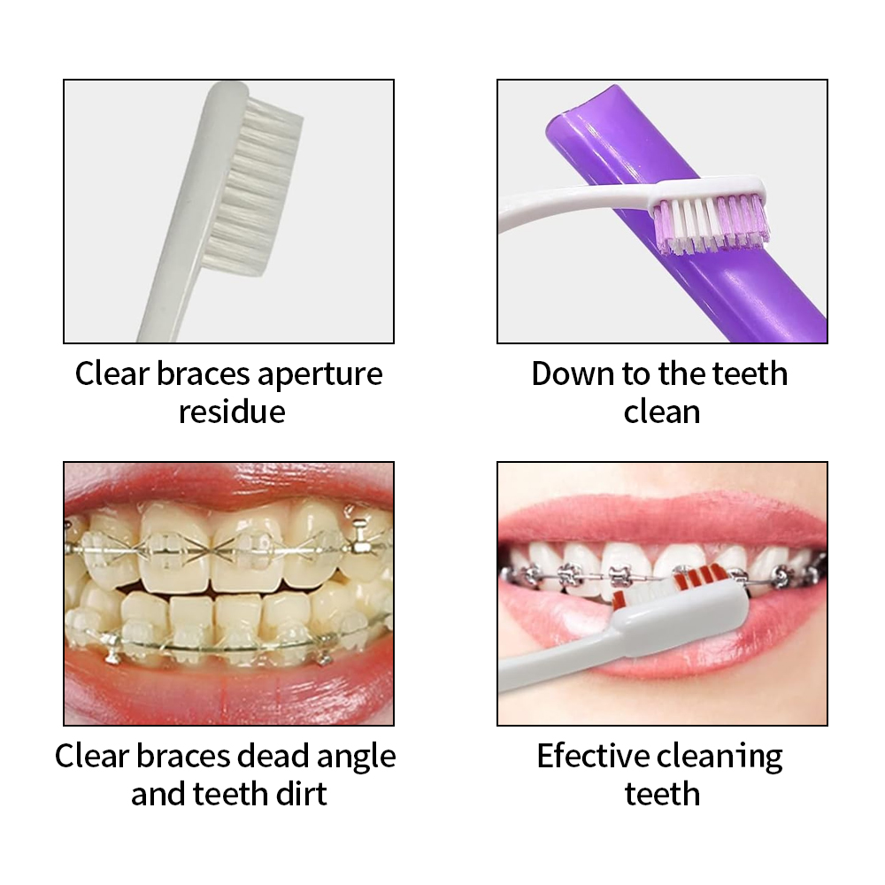 8Pcs/set Orthodontic Dental Ca - Teeth Whitening Brush avaliação e preço