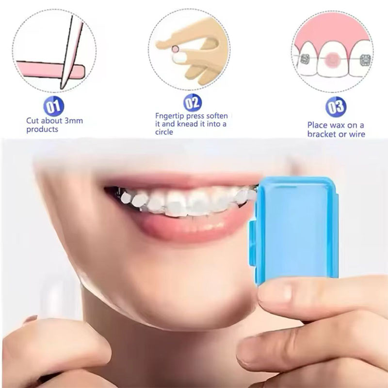 1set Orthodontic Dental Oral C - Teeth Whitening Brush avaliação e preço