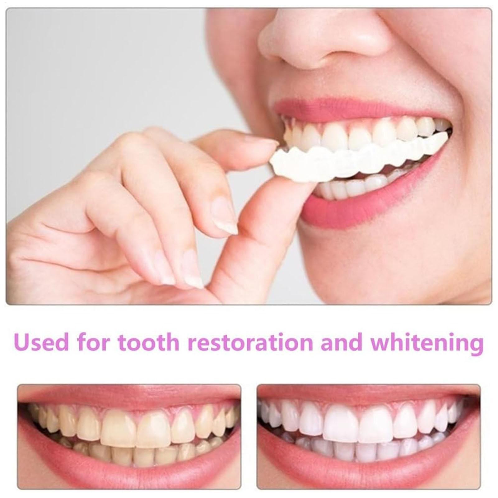 Dental Upper Lower Fake Teeth  - Teeth Whitening In Office avaliação e preço
