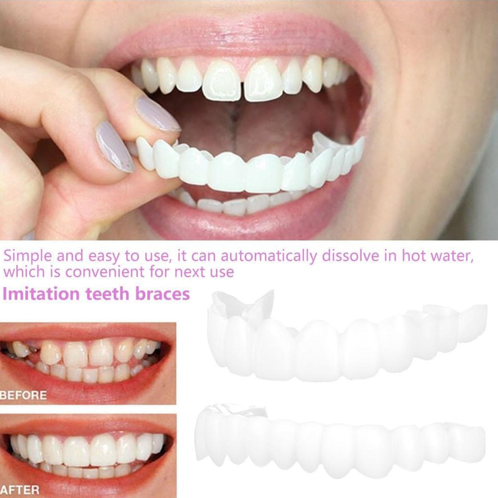 Dental Upper Lower Fake Teeth  - Teeth Whitening In Office avaliação e preço