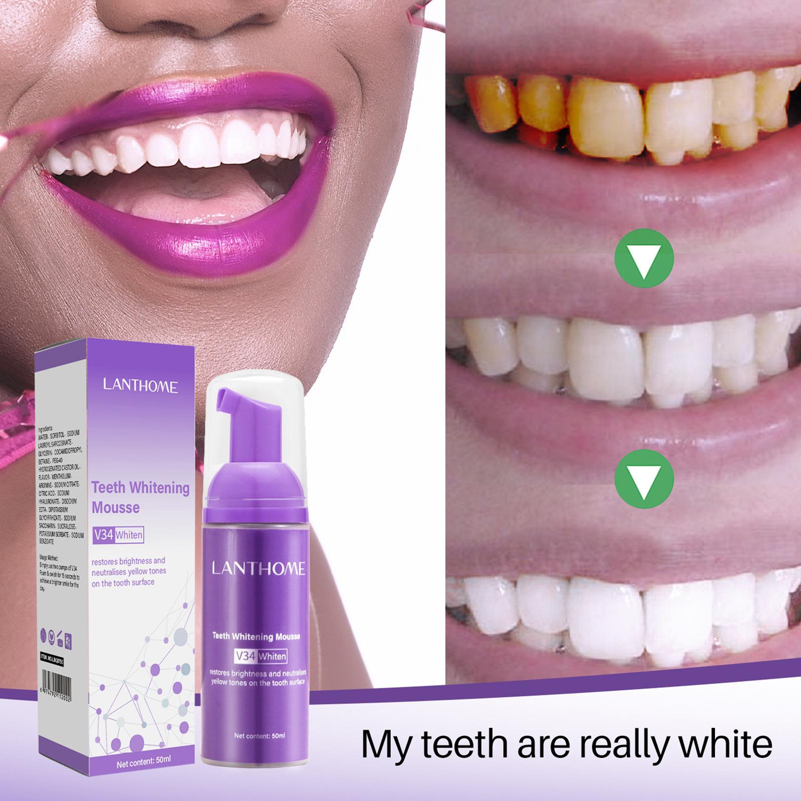 V34 Mousse Teeth Cleaning Toot - Teeth Whitening Effective avaliação e preço