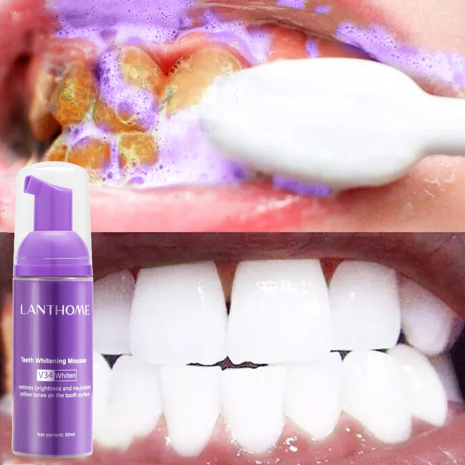 V34 Mousse Teeth Cleaning Toot - Teeth Whitening Effective avaliação e preço