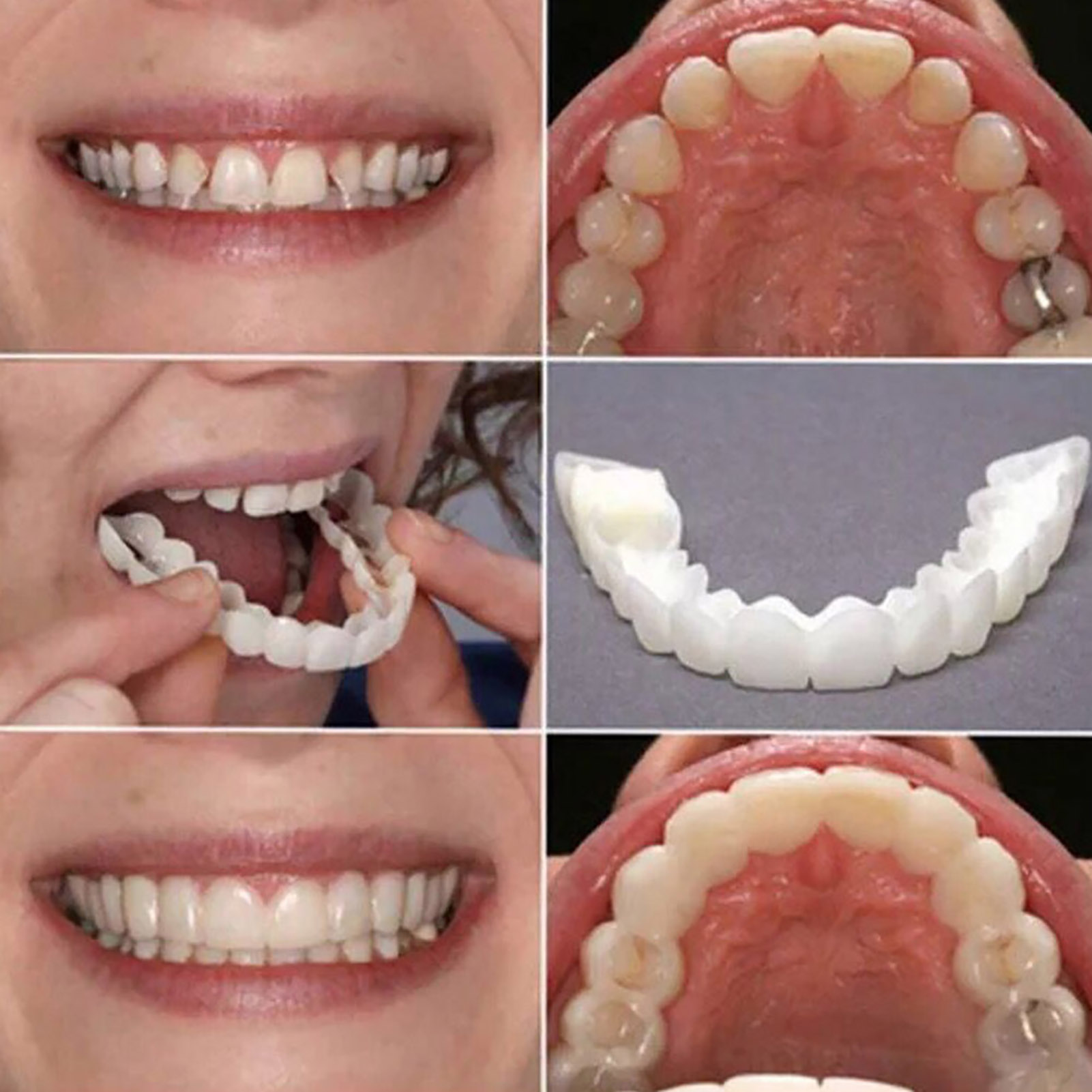 Daily Commute Teeth Veneers, T - Teeth Whitening In Office avaliação e preço