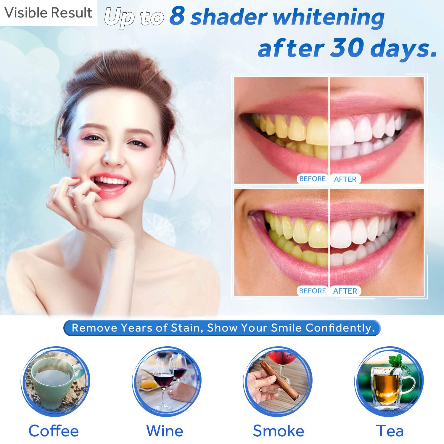 Teeth Whitening Gel Refill Syr - Teeth Whitening Singapore avaliação e preço