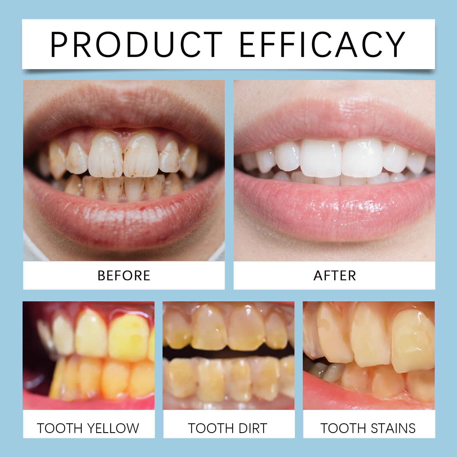 Feimuko 8ml Teeth Gel Pen Gent - Teeth Whitening Singapore avaliação e preço