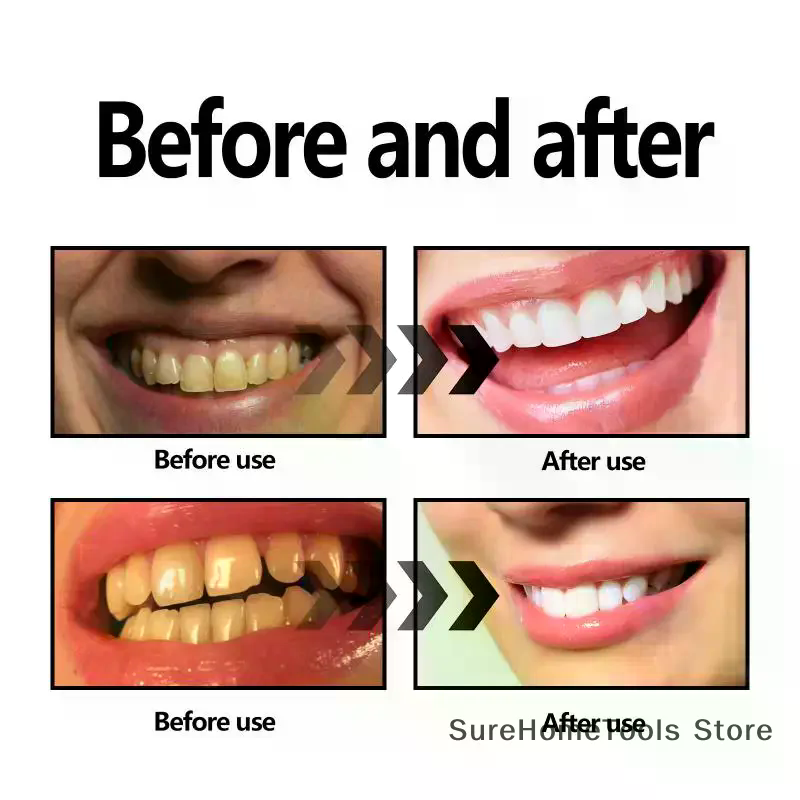 Bamboo Charcoal Powder For Tee - Teeth Whitening Charcoal avaliação e preço