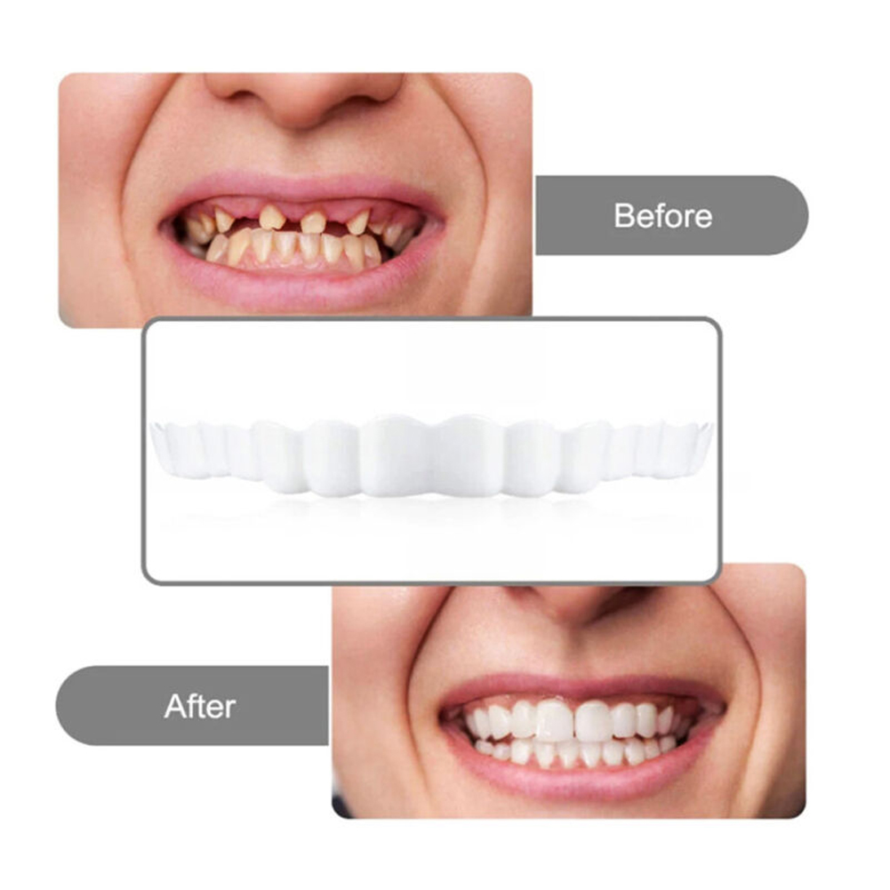 newSilicone Denture Set Fit Te - Teeth Whitening Free avaliação e preço