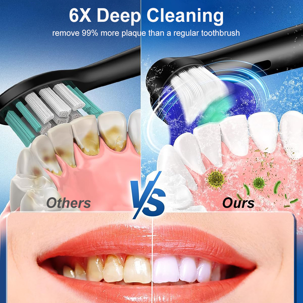 Electric Rotating Toothbrush D - Teeth Whitening Gel Refills avaliação e preço