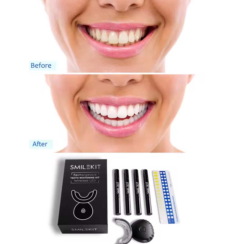 Wholesale Approved Private log - Teeth Whitening Light Kit avaliação e preço