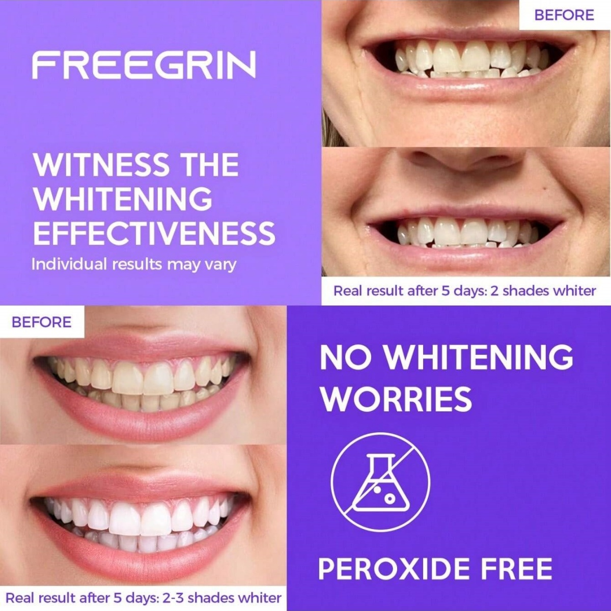 Deluxe Whitening Teeth Sticker - Teeth Whitening Singapore avaliação e preço