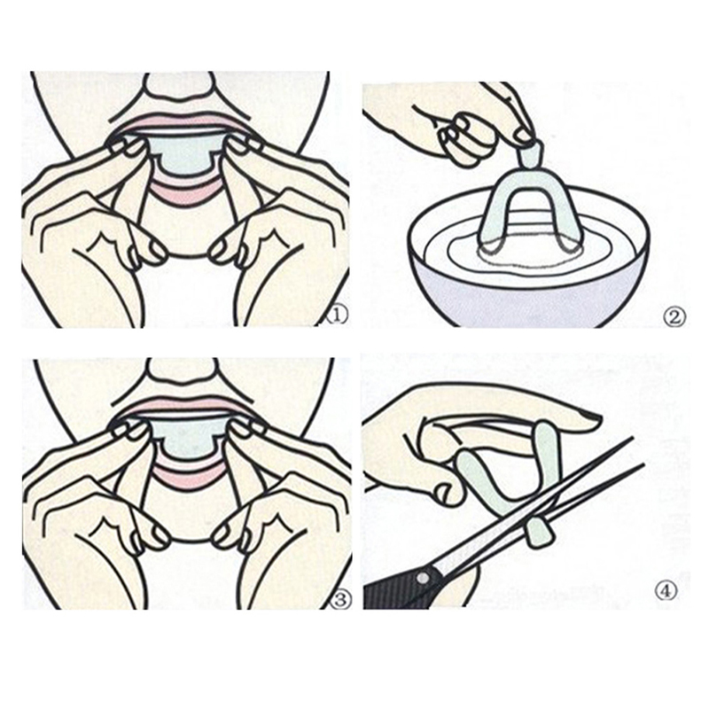 10Pcs Teeth Whitening Night Gu - Teeth Whitening With Trays avaliação e preço