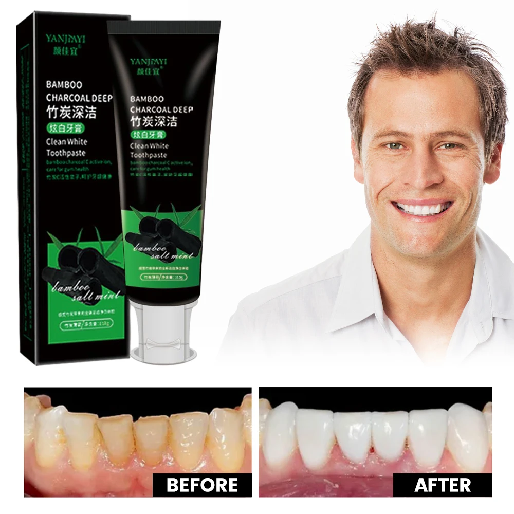 110g Bamboo Charcoal Black Too - Teeth Whitening Charcoal avaliação e preço