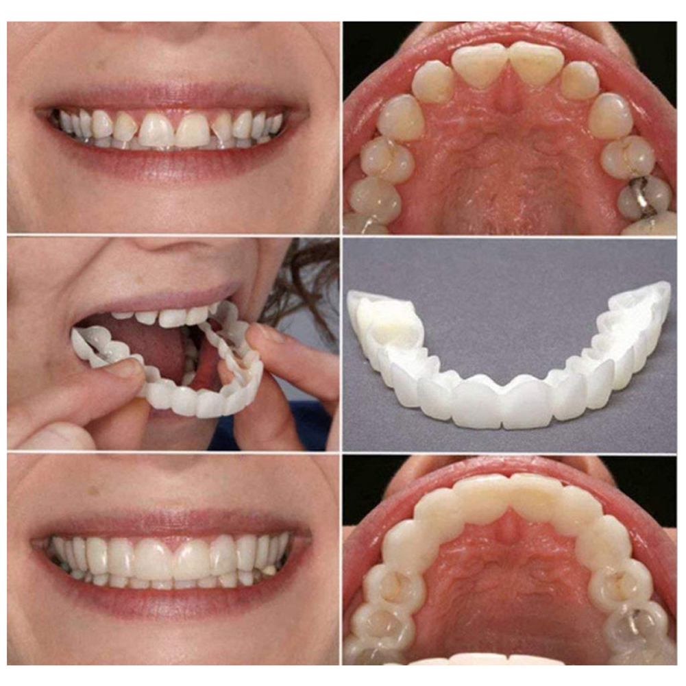2026icone Denture Set Fit Temp - Teeth Whitening Free avaliação e preço
