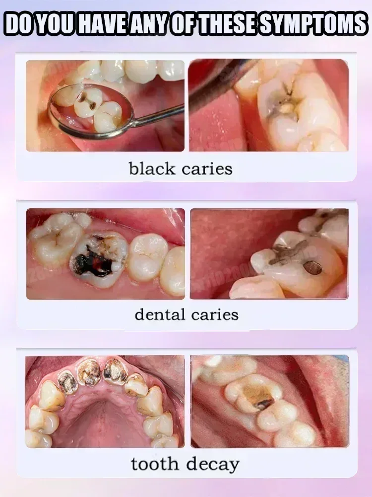 Teeth Cleaning Toothpaste Remo - Teeth Whitening Effective avaliação e preço