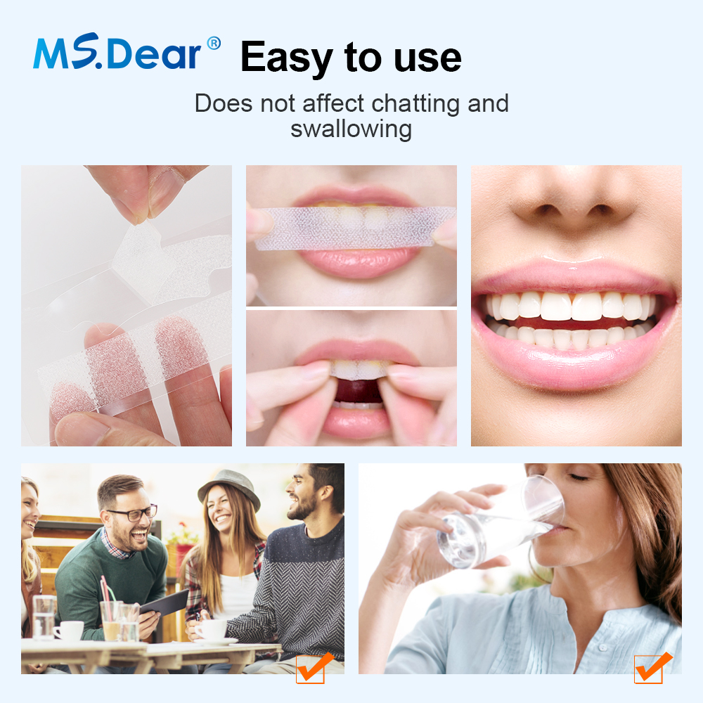 Teeth Whitening Strips Cleansi - Teeth Whitening Singapore avaliação e preço